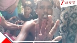 সিভিক ভলেন্টিয়ারের দাদাগিরি! আঙুল কেটে পড়ে গেল যুবকের! ভয়ংকর ঘটনা...