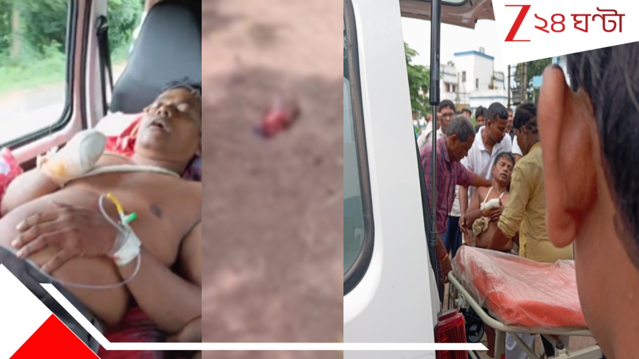 Bhagawanpur Incident: মেয়ের প্রেমিকের কাটারির এক কো*পে কবজি থেকে বাবার হাত কে*টে গড়াগড়ি রাস্তায়! হাড়হিম দৃশ্যে শিউরে উঠলেন পথচারীরা... Bhagawanpur Incident: মেয়ের প্রেমিকের কাটারির এক কো*পে কবজি থেকে বাবার হাত কে*টে গড়াগড়ি রাস্তায়! হাড়হিম দৃশ্যে শিউরে উঠলেন পথচারীরা...