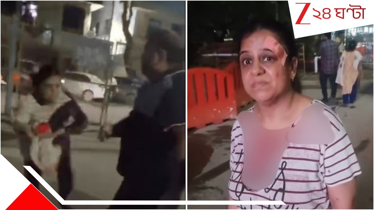Dog Feeders Brutally Thrashed: 'কুকুরকে খাওয়াচ্ছিলাম, তাই আমার বুকে, গোপনাঙ্গে পর্যন্ত...' প্রৌঢ়াকে মেরে র*ক্তা*ক্ত করে দিলেন আইনজীবী... ভয়ংকর ভিডিয়ো... Dog Feeders Brutally Thrashed: 'কুকুরকে খাওয়াচ্ছিলাম, তাই আমার বুকে, গোপনাঙ্গে পর্যন্ত...' প্রৌঢ়াকে মেরে র*ক্তা*ক্ত করে দিলেন আইনজীবী... ভয়ংকর ভিডিয়ো...
