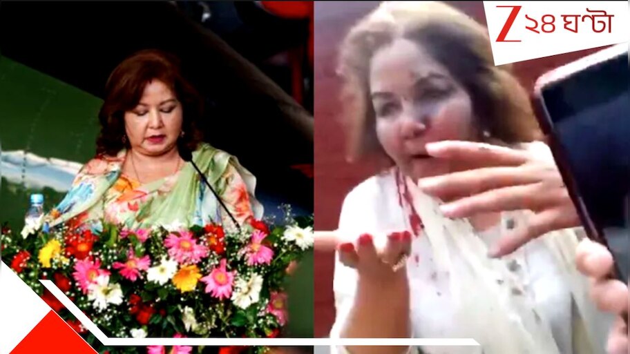 Nepal Protest Before & After Pic: ছিলেন মন্ত্রী, হলেন মৃতপ্রায়! মাত্র চারদিনে বদলের নেপাল, জেন Z-র জিঘাংসার মুখ আরজু রানি...