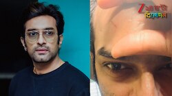 মেকআপ করতে গিয়ে রক্তারক্তি, মেকআপ আর্টিস্টের বিরুদ্ধে মামলা জীতুর?