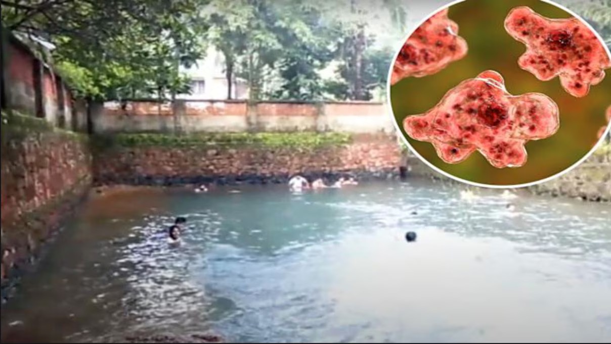 প্রতিরোধ: