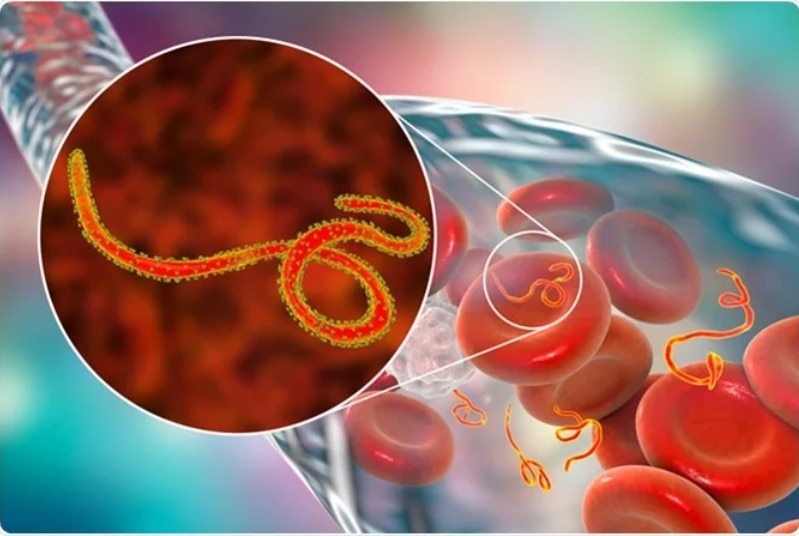 Ebola Outbreak, Pandemic Fear, Death rate 90 percent, Lockdown imposed