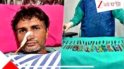 খেপে গেলেই খেতেন, যুবকের পেট থেকে বেরোল ২৯ চামচ, ১৯ টুথব্রাশ আর গোটাকয়েক পেন! 