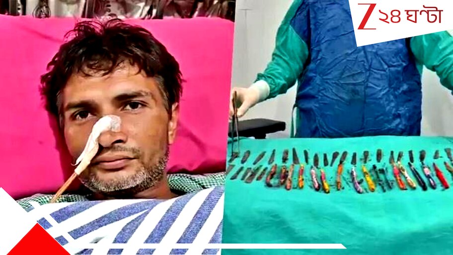 UP man's surprising habit: খেপে গেলেই খেতেন, যুবকের পেট থেকে বেরোল ২৯ চামচ, ১৯ টুথব্রাশ আর গোটাকয়েক পেন! সার্জন অবাক...