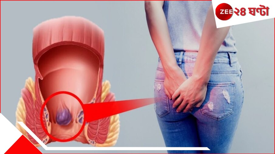 টয়লেটে ফোন? সাবধান! আপনার অজান্তেই বাড়ছে পাইলসের ৪৬% ঝুঁকি!