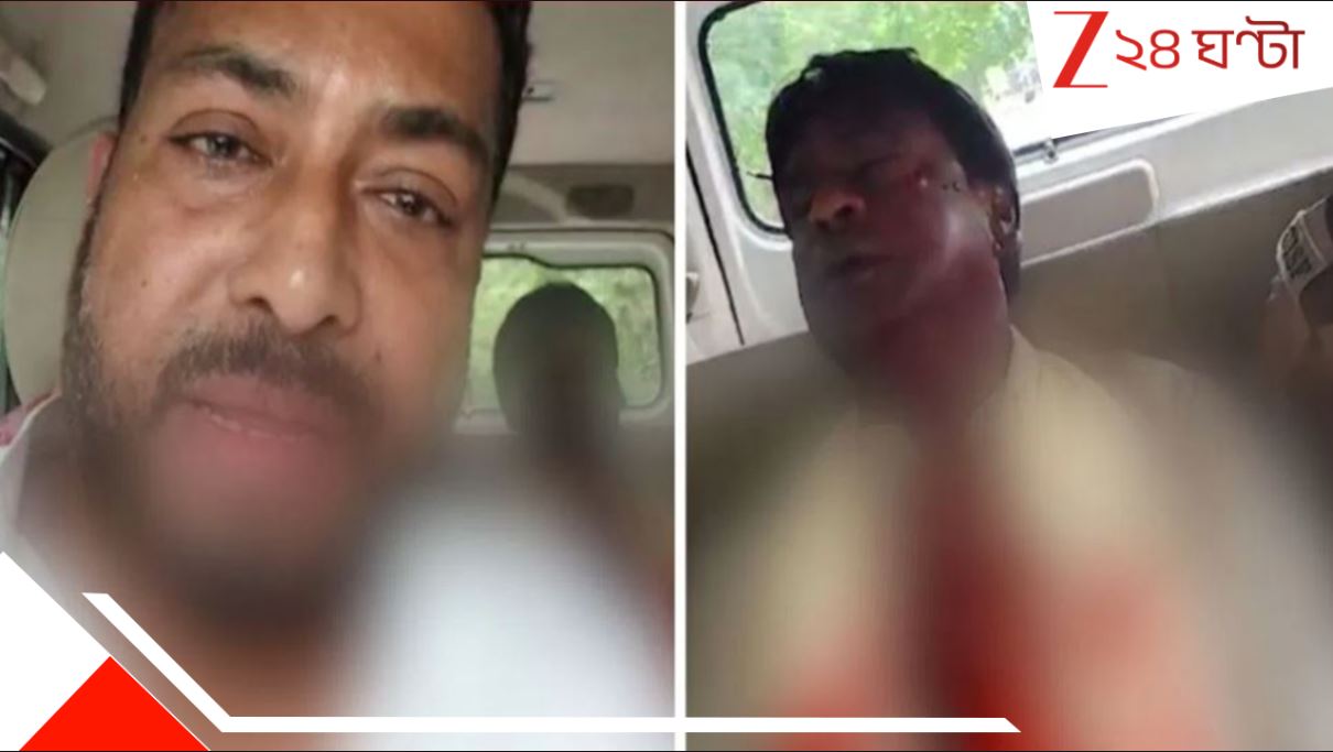 Watch Video of Khagen Murmu Attack in Nagrakata: বন্যাকবলিত নাগরাকাটায় ভয়ংকর আক্রান্ত বিজেপি সাংসদ খগেন মূর্মু, ঝরছে রক্ত! বিধায়ক শংকরকে জুতোপেটা... Watch Video of Khagen Murmu Attack in Nagrakata: বন্যাকবলিত নাগরাকাটায় ভয়ংকর আক্রান্ত বিজেপি সাংসদ খগেন মূর্মু, ঝরছে রক্ত! বিধায়ক শংকরকে জুতোপেটা...