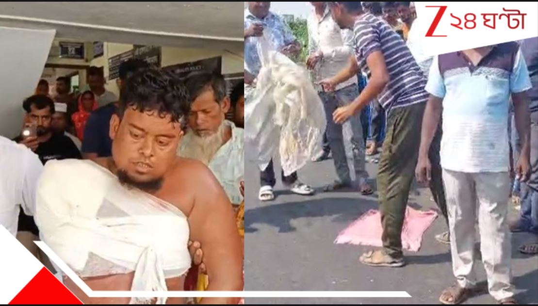 বহরমপুরে বিভীষিকা! যাত্রীবোঝাই বাস ও ট্রাকের মুখোমুখি সংঘর্ষ, রক্তে ভাসছে রাস্তা, পড়ে আছে কাটা হাত…3 injured in a road accidet at Murshidabads hariharpara