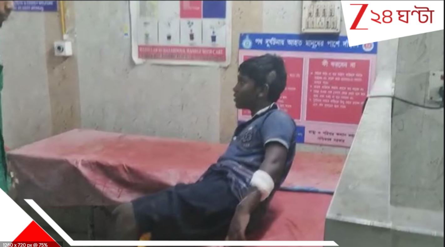 দেদার বিকোচ্ছে ‘নিষিদ্ধ বাজি’! চকোলেট বোমা ফাটাতে গিয়েই কিশোর.. ভয়ংকর দুর্ঘটনা…A minor boy injured while brusting crackers in sundarbon
