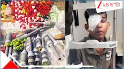 ভোপালের সঙ্গে জড়াল মালদা! কার্বাইড গান বিস্ফোরণে দৃষ্টিহীন হতে চলেছে জেলার বহু