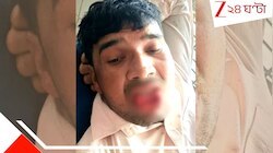 চুমু কেন খাচ্ছ! বলেই হামলে পড়া টক্সিক এক্স বয়ফ্রেন্ডের জিভ কামড়ে ছিঁড়ে দিল যুবতী.
