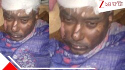 ইউনূসের বাংলাদেশে সন্ত্রাসবাদের দাপাদাপি! হিন্দু হওয়ার অপরাধে গায়ে আগুন খোকন দাসের