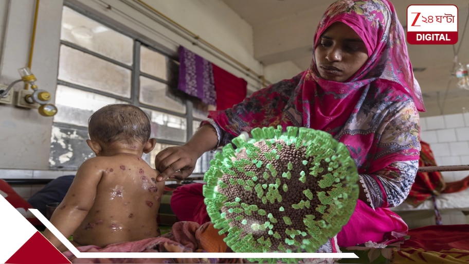 Measles Outbreak?: এখনই ৫০০ মৃত্যু, ৬০০০০ সংক্রমণ-কেস; হাসপাতালে ভর্তি ৪৬ হাজার ৪০৭ জন; নয়া মহামারি?