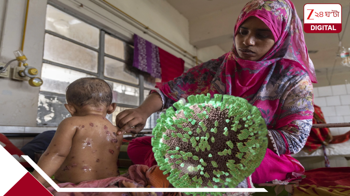 Measles Outbreak?: এখনই ৫০০ মৃত্যু, ৬০০০০ সংক্রমণ-কেস; হাসপাতালে ভর্তি ৪৬ হাজার ৪০৭ জন; নয়া মহামারি? Measles Outbreak?: এখনই ৫০০ মৃত্যু, ৬০০০০ সংক্রমণ-কেস; হাসপাতালে ভর্তি ৪৬ হাজার ৪০৭ জন; নয়া মহামারি?