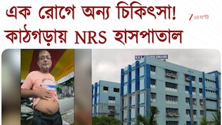 গলব্লাডারের অপারেশনের জন্য ভর্তি হয়ে অ্যাপেন্ডিক্সের চিকিত্সা, কাঠগড়ায় NRS