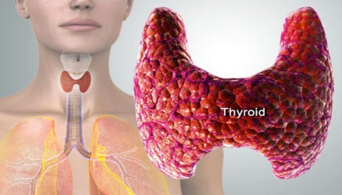 Thyroid