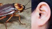Cockroach from Ear: কান থেকে বেরিয়ে এল আস্ত এক আরশোলা!