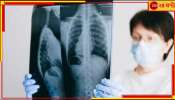 World Tuberculosis Day 2023: আজ বিশ্ব যক্ষা দিবস, কীভাবে ছড়ায় এই রোগ? কতটা বিপজ্জনক?