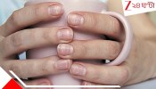 White Spot on Nails: নখে সাদা দাগ? হতে পারে বড় রোগের লক্ষণ...