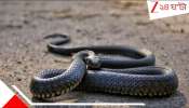 Snake Bite: সাপের ছোবেল হার্ট বন্ধ! মৃত্যুর মুখ থেকে ফিরল নাবালক... সরকারি হাসপাতালেই...