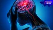 World Stroke Day 2025: হাত-পা অবশ, কথা বন্ধ, চোখ ঝাপসা! দেরি করলেই বিপদ... এই ঘাতক রোগ নিঃশব্দে শেষ করে দেবে...