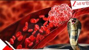 Wrong Blood: ১৬ দিন আগে সাপের ছোবল খাওয়া রোগীর দেহে চলে গেল ভুল রক্ত! নামবিভ্রাটেই রক্তবদল... ভয়ংকর