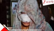 Husband bites wife nose:  দাম্পত্য কলহে রক্তারক্তি কাণ্ড: এক কামড়ে স্ত্রীর নাক ছিঁড়ে নিলেন স্বামী