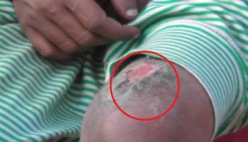 চুরি করতে না চাইলেই গরম তাওয়া, লোহার শিকের ছ্যাঁকা!