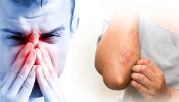 রোজ ঘুম থেকে উঠেই কি অনর্গল হাঁচি শুরু হয়ে যায়? জেনে নিন কী করবেন