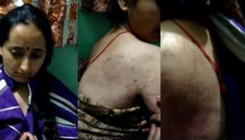 ভিডিয়ো: বধূর হাত-পা বেঁধে রাতভর মার স্বামী-শ্বাশুড়ির, সারা গায়ে কালশিটে দাগ