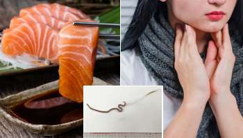 কাঁচা মাছ খাওয়ার পর গলায় প্রচন্ড ব্যাথা যুবতীর, এর পর যা হল...