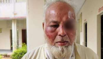  "জয় শ্রী রাম" না বলায় গফফরের চোখ-মুখ-দাঁত ফাটিয়ে দিল দুষ্কৃতীরা