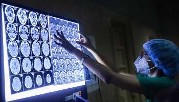 পেটেও হানা দিল 'Black Fungus', ক্ষুদ্রান্তে তৈরি হচ্ছে ক্ষত