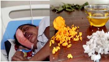 Black Fungus থেকে বাঁচতে বাদাম, বিটনুন, সরষের তেল, হলুদের মিশ্রণ! কী বলছে কেন্দ্র? 