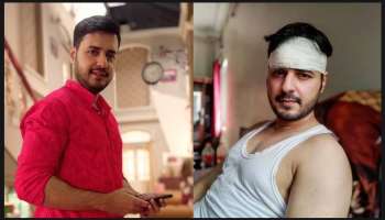 দুর্ঘটনার কবলে 'মিঠাই'-র 'আদিত্য', মাথায় পড়ল ৫টা সেলাই