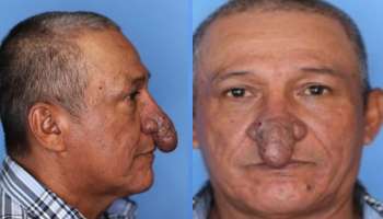 America: নাক না যৌনাঙ্গ! বড়দিনেই 'বড়' উপহার পেলেন এই ব্যক্তি