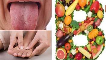 Vitamin B12: শরীরে ভিটামিন B12-র ঘাটতিতে হতে পারে 'বিপদ', জেনে নিন কী কী খাবেন