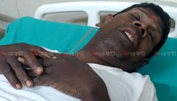 Bhuban Badyakar, Kacha Badam Viral Song: দুর্ঘটনার কবলে 'কাঁচা বাদাম' খ্যাত ভুবন বাদ্যকর, ভর্তি হাসপাতালে
