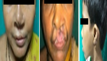 Goat Cartilage In Human Body: মানুষের শরীরে ছাগলের কার্টিলেজ! রাজ্যের গবেষকদের 'তাক লাগানো' উদ্ভাবন