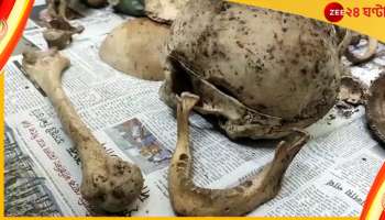Siliguri skeleton: আর্বজনার স্তুপে বস্তাবন্দি খুলি, হাড়গোড়! আতঙ্ক শিলিগুড়িতে