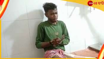 Mobile Blast: পকেটে রাখা মোবাইলে বিস্ফোরণ! হাওড়ায় গুরুতর জখম যুবক