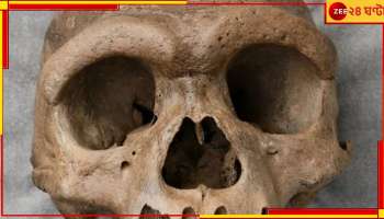 Malda Skeleton: পুরসভার পার্কিং লটে কাটা মুণ্ডু! শহরে আতঙ্ক