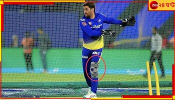 Mahendra Singh Dhoni: লক্ষ্য ২০২৪-এর আইপিএল, হাঁটুর অস্ত্রোপচার করাতে পারেন 'ক্যাপ্টেন কুল' 