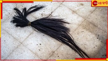 Tribal Woman Assaulted: ডাইনি অপবাদ দিয়ে প্রৌঢ়ার উপরে নারকীয় অত্যাচার, বেধড়ক মার-মাথায় চলল ব্লেড.....