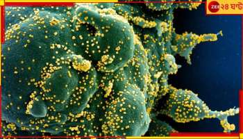 Covid JN.1: ফের বিশ্ব জুড়ে দ্রুত ছড়াচ্ছে করোনার নতুন ধরন! উদ্বিগ্ন &#039;হু&#039;...