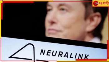 Elon Musk | Neuralink: এবার ‘ভাবলেই’ কেল্লা ফতে! ম্যাজিক দেখালেন এলন মাস্ক...