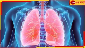 After Covid Lung Damage: কোভিডে আক্রান্ত ভারতীয়রা ফুসফুসের সমস্যায় জর্জরিত! 