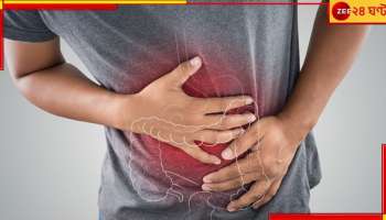 Diarrhoea: দুয়ারে ডায়ারিয়া, সঙ্গে সর্দিকাশি! কলকাতা কাঁপছে ভাইরাসে...