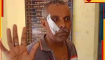 Attack on Deputy Magistrate: হাসপাতালে ভাইকে দেখতে গিয়ে 'আক্রান্ত' ডেপুটি ম্যাজিস্ট্রেট!