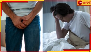 Hooghly: অস্বাভাবিক! ৭২ ঘণ্টা ইরেকশনে অতিষ্ঠ যুবক অবশেষে 'মুক্তি' পেলেন পুরুষাঙ্গের জটিল অস্ত্রোপচারে...